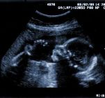 ultrasound[2]